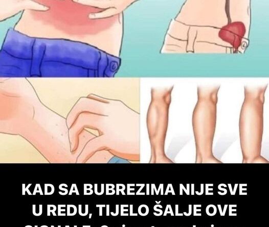 KAD SA BUBREZIMA NIJE SVE U REDU TIJELO ŠALJE OVE SIGNALE 6 simptoma